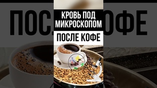 Влияние кофе на бактерии в крови. Эксперимент по микроскопом