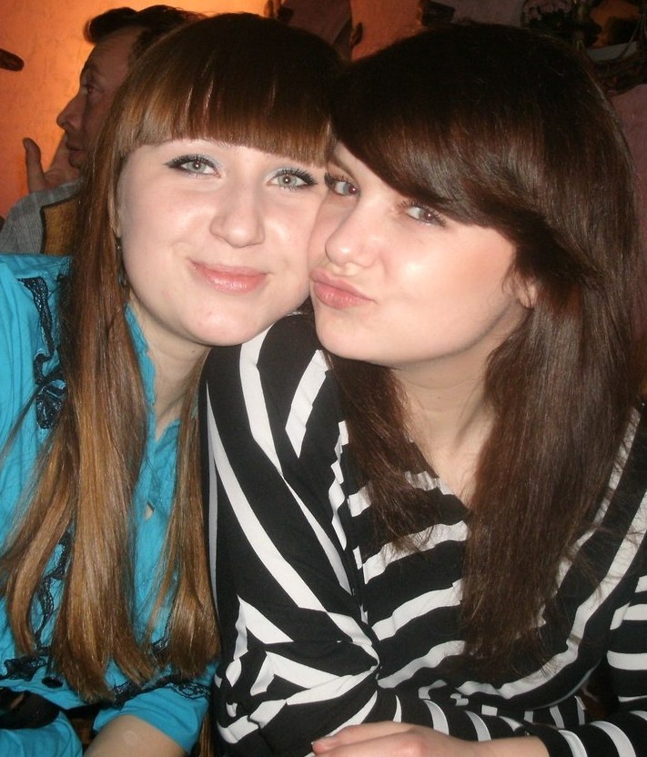 Анна Швец | Синяк