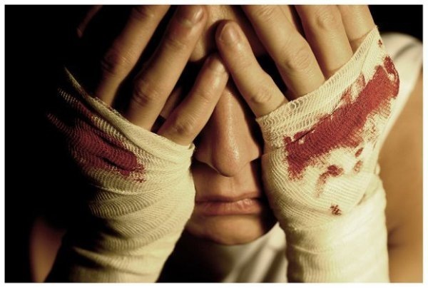 №155, Марлен Зиядинов №155, Марлен Зиядинов