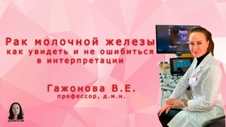 Рак молочной железы как увидеть и не ошибиться в интерпретации. Профессор Гажонова В.Е.